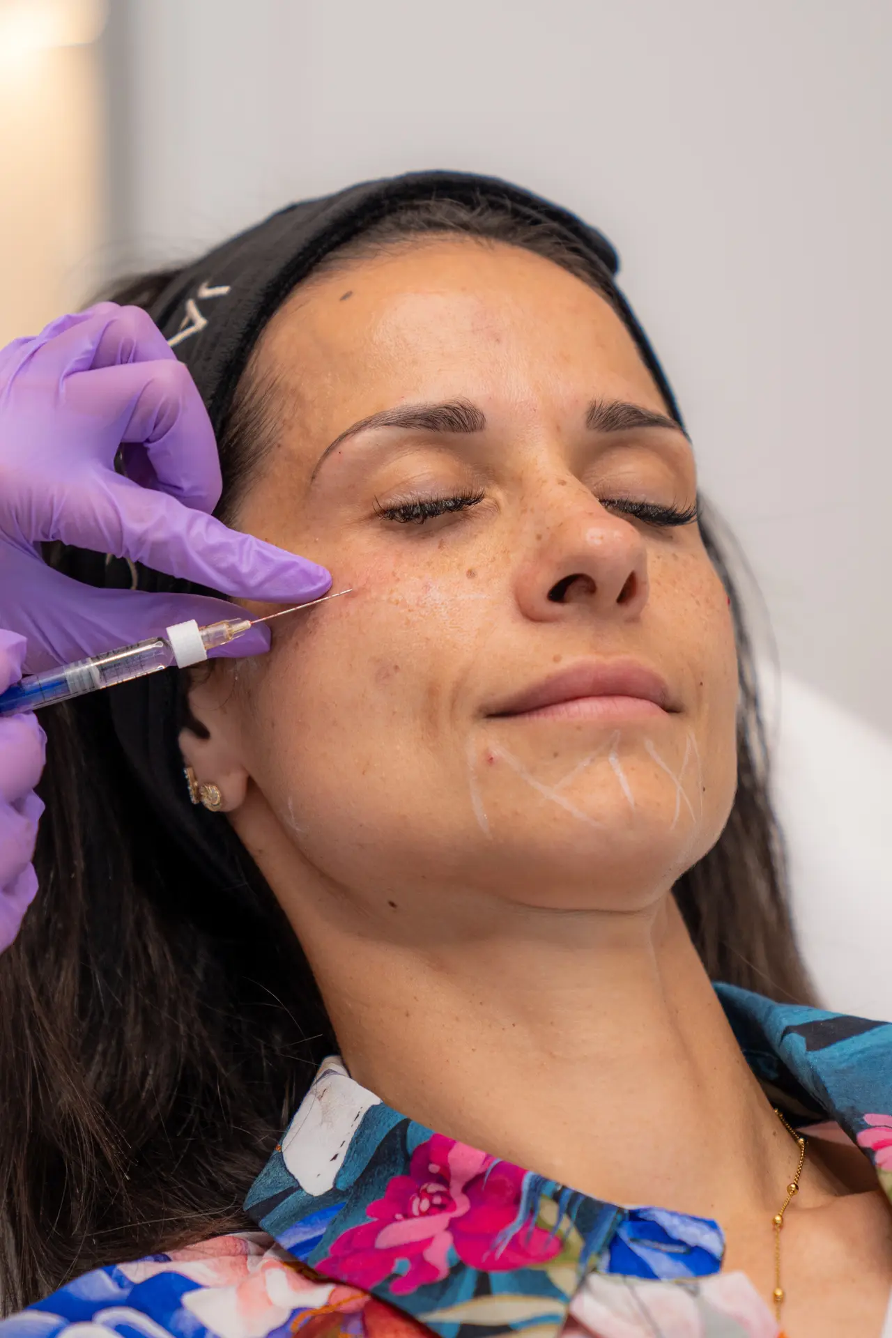 Estetická a regeneratívna dermatológia — fotografia 5